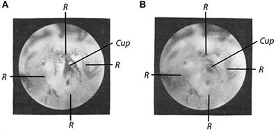 Translations of Steinhausen's Publications Provide Insight Into Their Contributions to Peripheral Vestibular Neuroscience